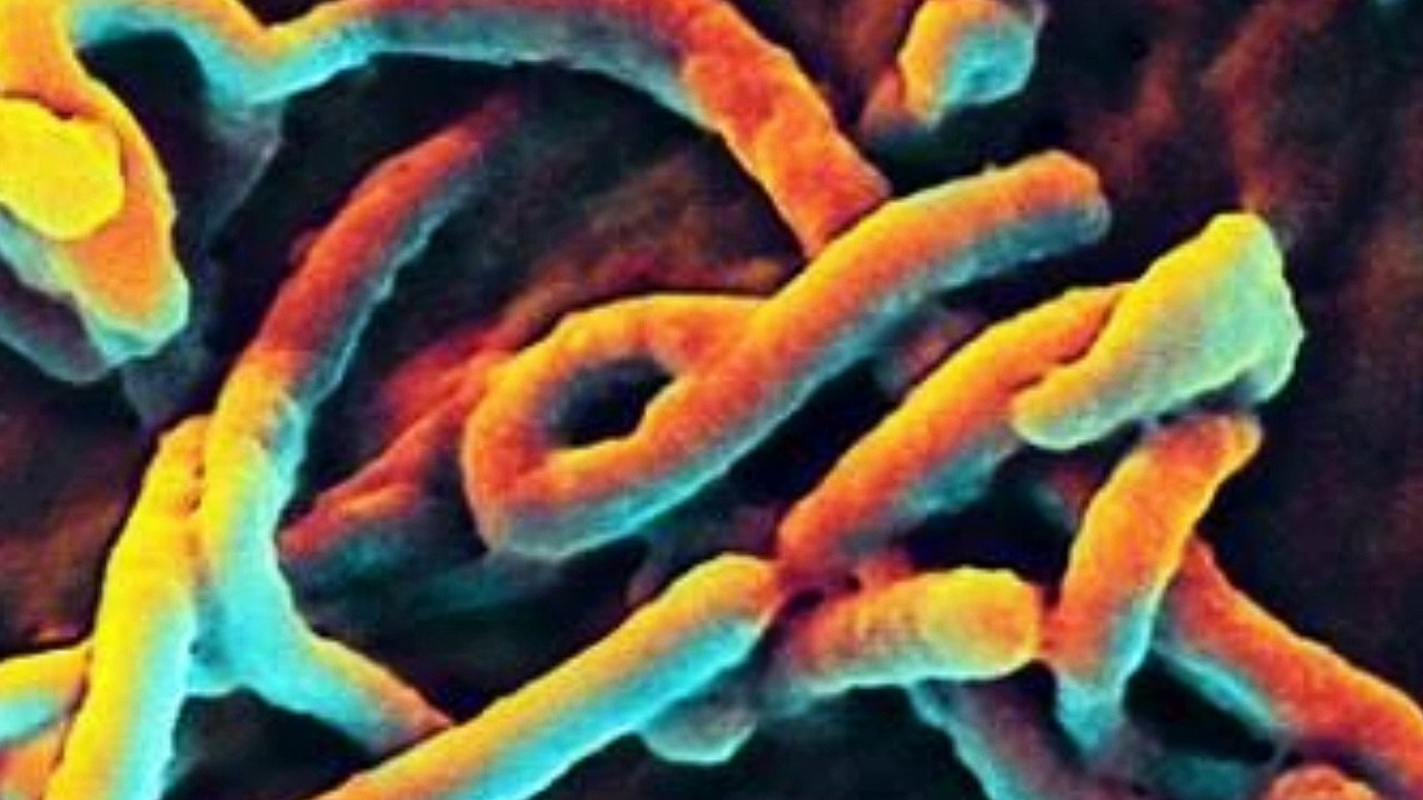 आने वाली है कोरोना से भी खतरनाक महामारी, WHO बोला- दुनिया में आ जाएगी तबाही, जानिए इस नए वायरस के बारे में