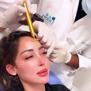بسمة بوسيل تجري عملية حقن لوجهها على يد ابنة أصالة