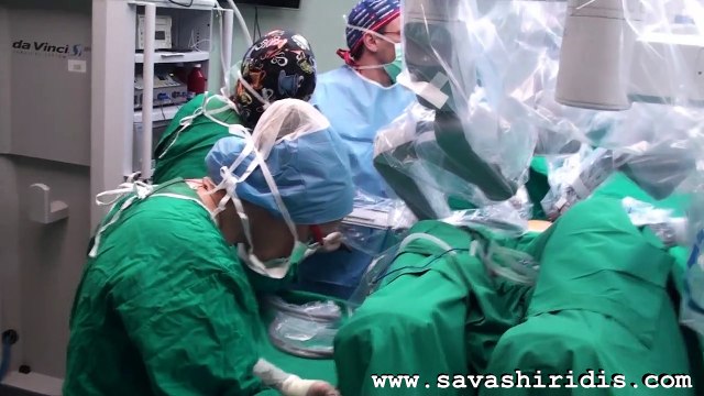 Ρομποτικη Χολοκυστεκτομη Μιας Τομης 2011 - Robotic Single Site Cholecystectomy 2011