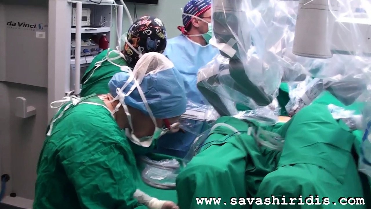 Ρομποτικη Χολοκυστεκτομη Μιας Τομης 2011 - Robotic Single Site Cholecystectomy 2011