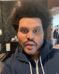 La 'verdad' detrás del extraño aspecto del rostro de The Weeknd