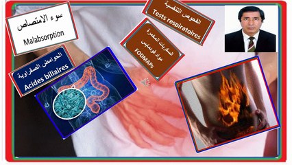 malabsorption et colon irritable