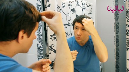 تساقط الشعر