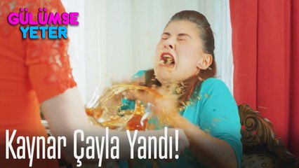 Kaynar çayla yandı