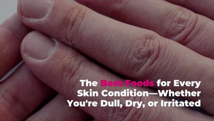 The Best Foods for Every Skin Condition—Whether You're Dull, Dry, or Irritated
