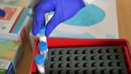 La cifra de muertos diarios por covid-19 se mantiene en máximos en Alemania