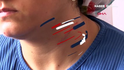 Boşanmak istediği eşi tarafından boğazı kesilen Esra Oymak: Cezaevinden mektup yazarak tehdit ediyor