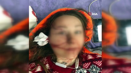 Falçatalı saldırıya uğrayan kadından sosyal medyada yardım çığlığı