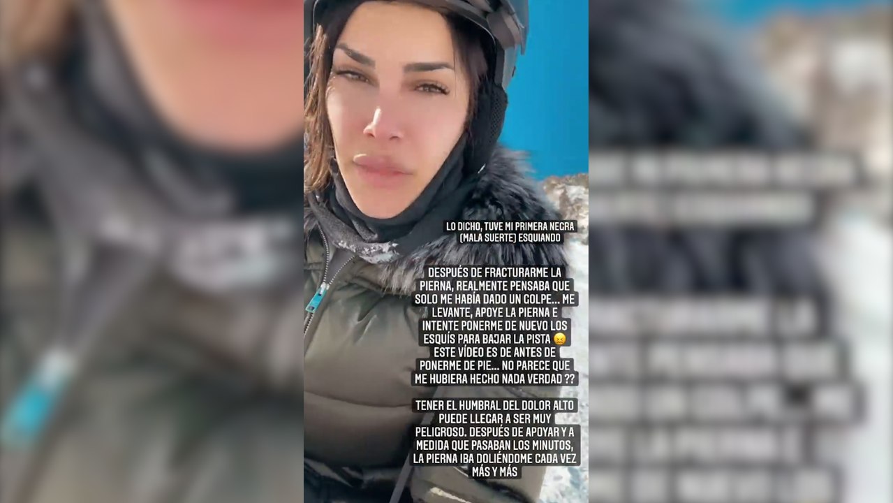 Carla Barber comparte imágenes de su operación tras fracturarse la tibia