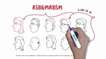 Explain astigmatism and Toric IOLs for cataract in english