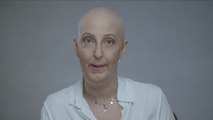 Un documental muestra la belleza de uno de los efectos más temidos del cáncer
