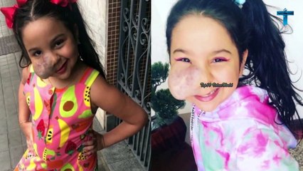 Top 10 Most Unusual Kids Born With Unbelievable Medical Conditions