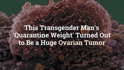 This Transgender Man’s ‘Quarantine Weight’ Turned Out to Be a Huge Ovarian Tumor