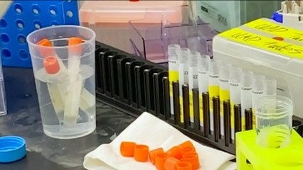 CMO: Private Hospitals Can Import Vaccines