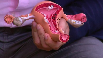 bd-causas-de-sangrados-despues-de-la-menopausia-210121