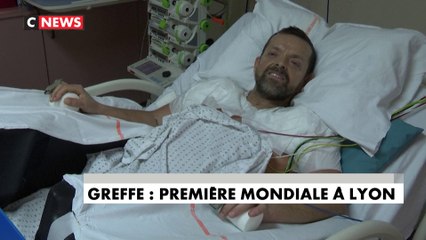 Lyon : un homme reçoit la première greffe de bras au monde