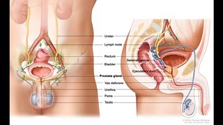 Case of Meningioma during Luteinizing Hormone-Releasing Hormone Agonist Prostate Cancer Treatment