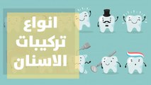 انواع تركيبات الاسنان و التركيبات التجميلية