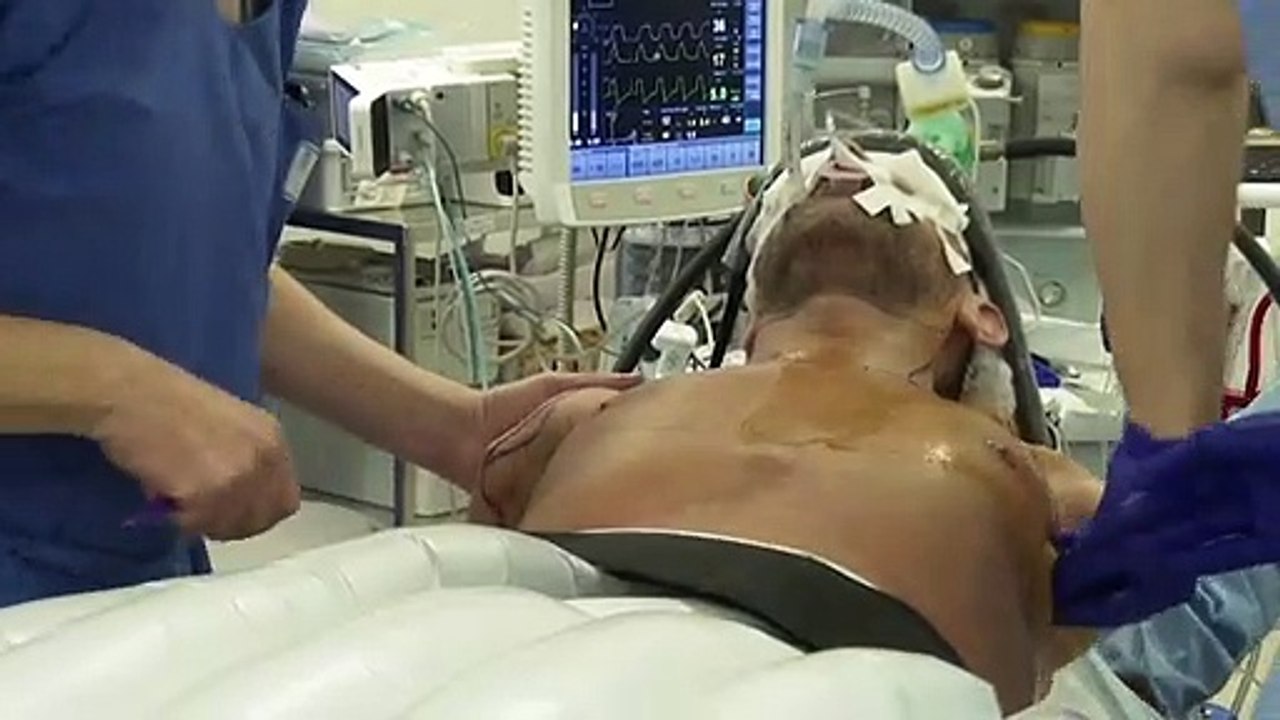 Weltpremiere: isländer bekommt arme und schultern transplantiert