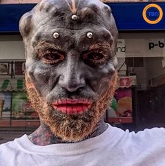 Celui que l'on nomme "Black Alien" se fait enlever le nez et la lèvre supérieure...
