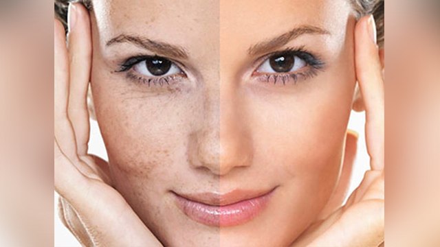 गोरी चमकदार चेहरा पाने लगाने के लिए लगाएं ये होममेड पैक । Homemade Pack For Glowing Skin । Boldsky
