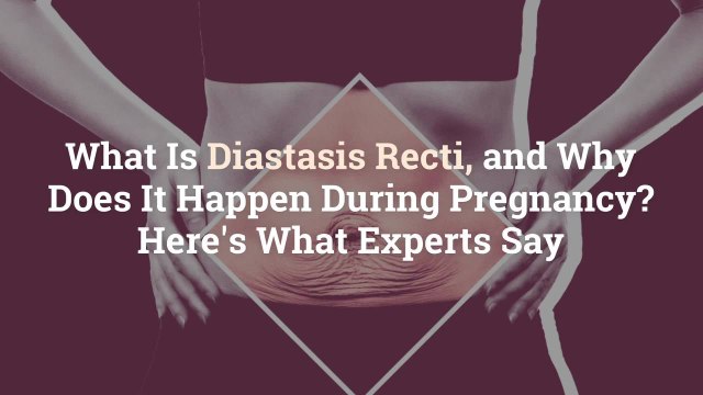 What Is Diastasis Recti, and Why Does It Happen During Pregnancy? Here's What Experts Say