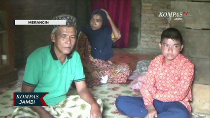Anak Penderita Sakit Kulit Dibantu Kapolres Merangin