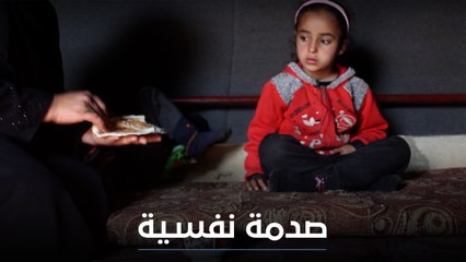 "أنا عم بخجل من البنات".. مرض يصيب طفلة بعقدة نفسية