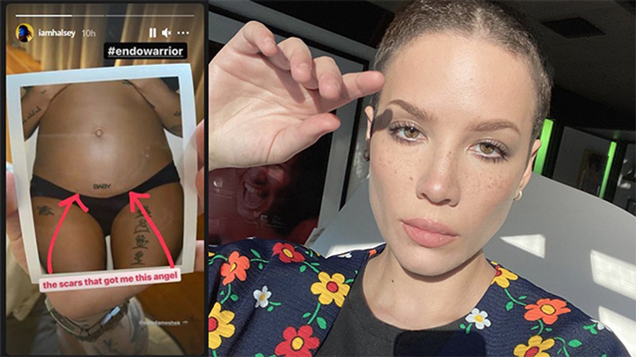 Halsey Pregnant: Singer Halsey Debuts Baby Bump...
