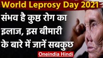 World Leprosy Day: कुष्ठ रोग के बारे में फैली हुईं भ्रातियों को जानिए | वनइंडिया हिंदी