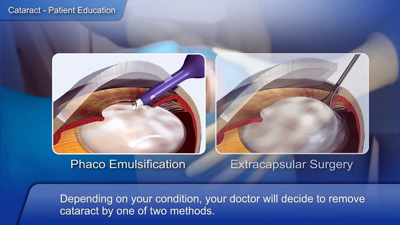 5_Cataract surgery_English