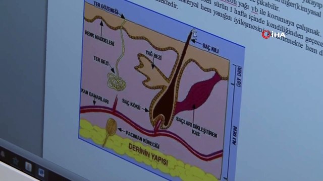 Yanık Vakalarında Doğru Bilinen Yanlış Uygulamalar