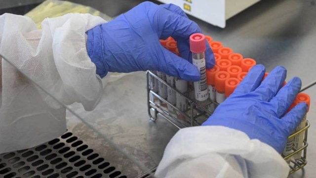 Mujer contagiada con cepa P1 de covid de Brasil fue atendida en Leticia, Amazonas