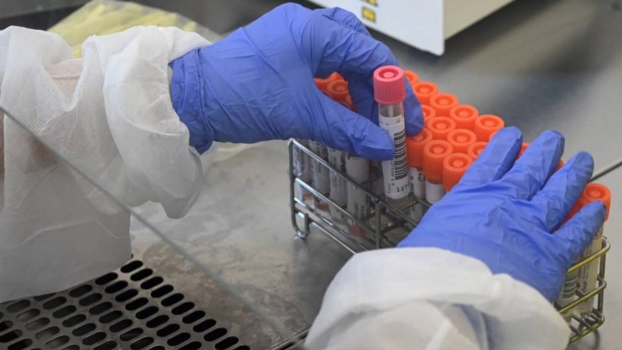 Mujer contagiada con cepa P1 de covid de Brasil fue atendida en Leticia, Amazonas