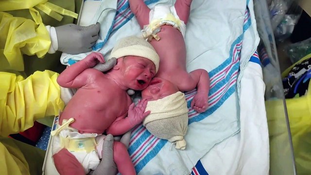 Ce jumeaux s’arrêtent de pleurer dès qu'on les colle ensemble