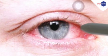 ข่าวค่ำ (ช่วงที่ 5) วันจันทร์ที่ 1 กุมภาพันธ์ 2564