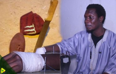 Couvre feu à Yeumbeul : Un indicateur blesse un tailleur, il est envoyé dans le coma par les voisins