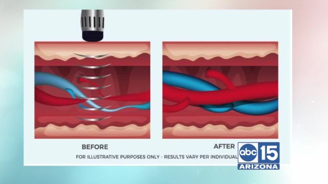 Do you have self-improvement goals this year? Camelback Medical Clinic can help with ED