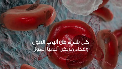 كل شيء عن أنيميا الفول وغذاء مريض أنيميا الفول