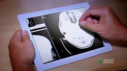 Pesquisa demonstra que Covid-19 pode afetar funções do cérebro