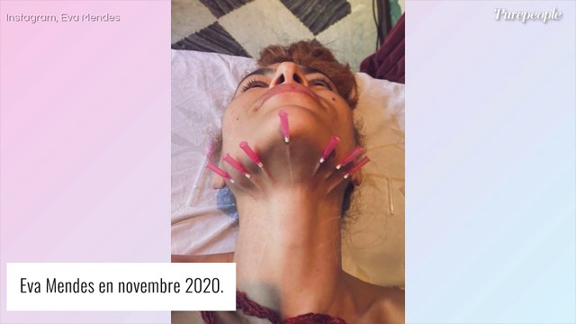 Eva Mendes : Je n'ai jamais nié avoir fait de la chirurgie esthétique