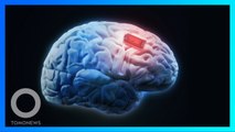 Implan Otak Seukuran Garam Untuk Manipulasi Stres - TomoNews