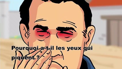 Pourquoi a-t-il les yeux qui piquent ?