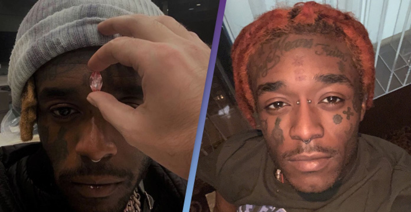 Lil Uzi Vert Has 24 Million Pink Diamond Implanted Into His Forehead Video Dailymotion
