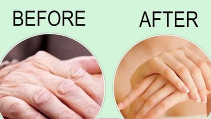 हाथों की सुंदरता बढ़ाने और झुर्रियां दूर करने के लिए अपनाएं ये घरेलू नुस्खे । Wrinkle Free Hands