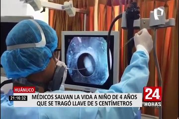 Huánuco: médicos realizaron exitosa operación a niño que se tragó una llave