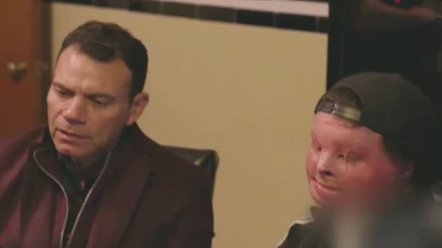 Un joven de 22 años es la primera persona en someterse a un doble transplante de cara y manos con éxito en Estados Unidos