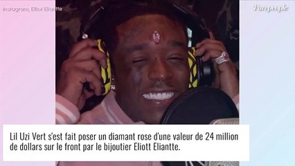Lil Uzi Vert : Il se fait implanter un énorme diamant hors de prix sur le front !
