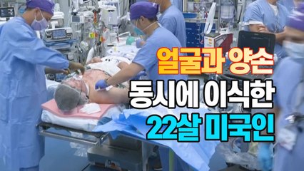 [세상만사] 얼굴과 양손 동시에 이식 수술한 남자 / YTN