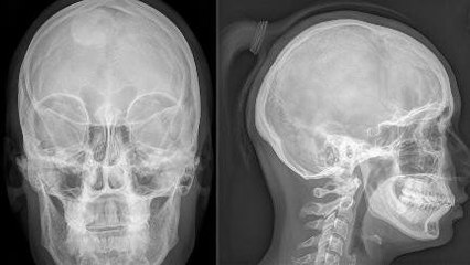 Struktur Wajah Pria Dirancang Buat Terima Tamparan